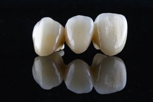 dental bridge against a black background