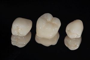 Three dental crowns in West Monroe, LA on a reflective surface