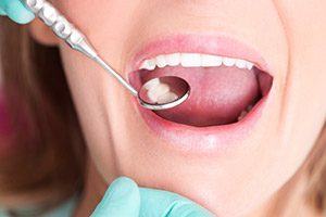 Closeup of patient receiving dental sealants