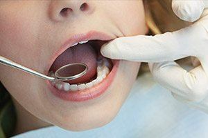 Closeup of child receiving fluoride treatment