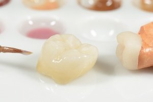 Dental crown on tabletop before restorative dentistry treatment