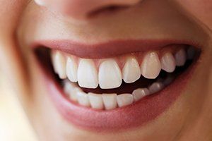 Closeup of beautiful smile after full mouth reconstruction