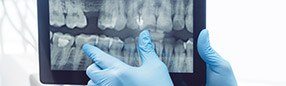 Digital dental x-rays