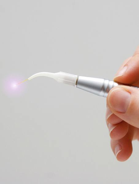 Soft tissue laser dentistry hand tool