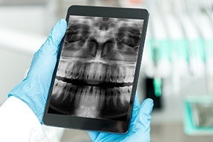 Dental x-rays on tablet computer