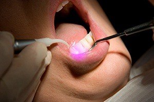 Patient receiving soft tissue laser dentistry