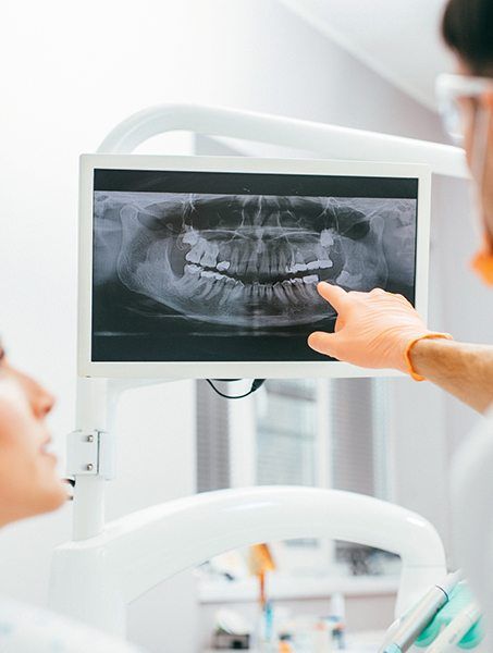Digital panoramic dental x-rays
