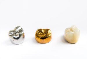 Ceramic, gold and silver dental crowns.